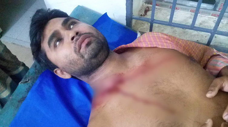 Ein Mann aus Bangladesch hat schwere Verletzungen auf seinem Oberkörper erlitten