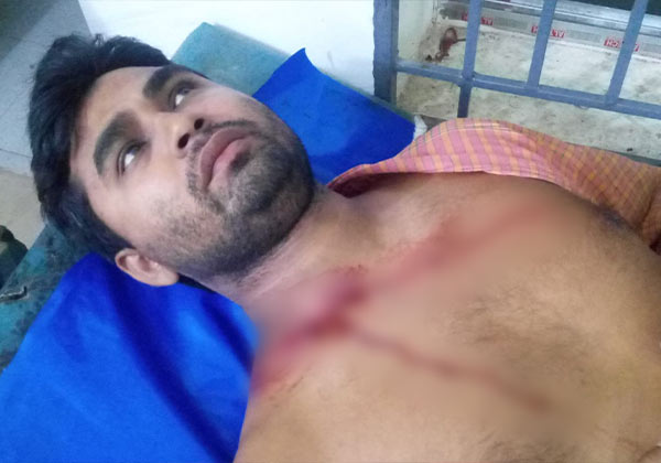 Ein Mann aus Bangladesch hat schwere Verletzungen auf seinem Oberkörper erlitten