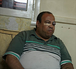 Ägypten: bei Anschreitungen in Kairo wurde Ramses Roushdy am Auge verletzt/Compass Direct
