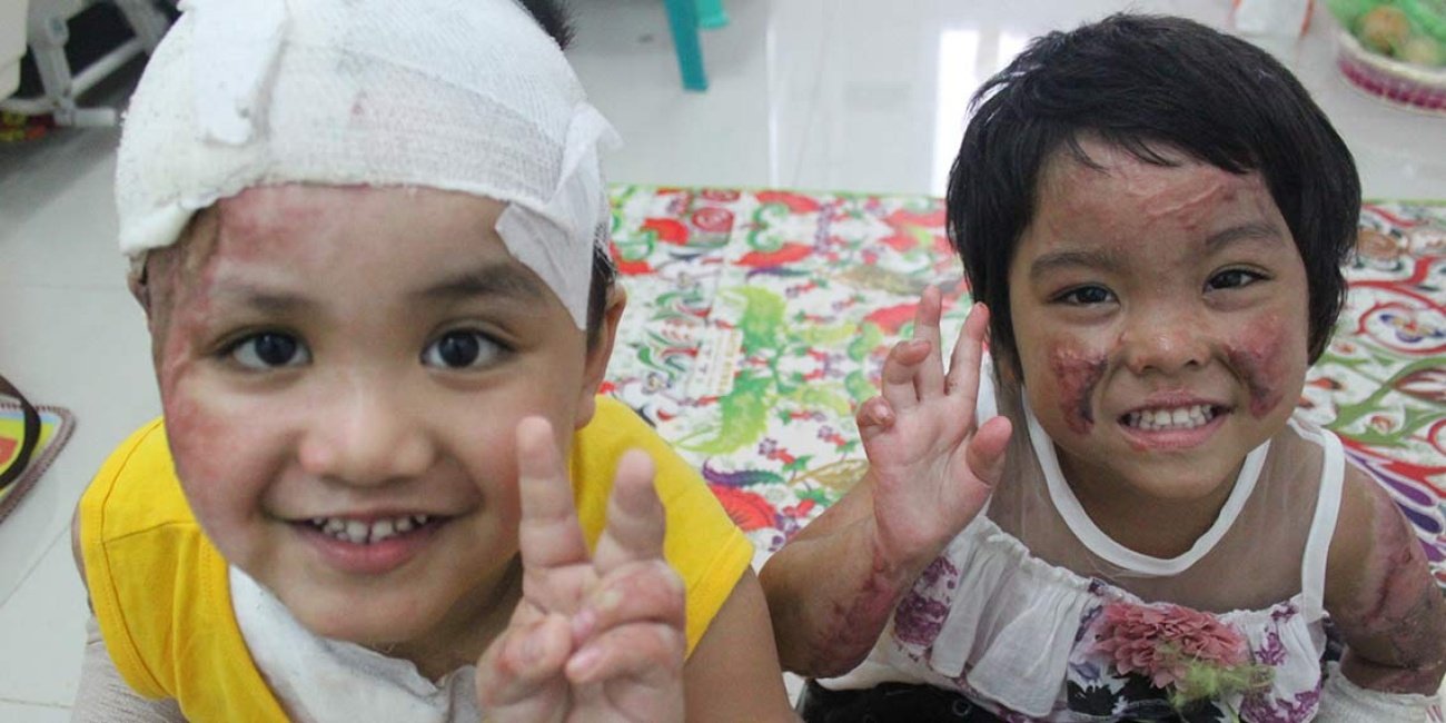 Alvaro (4) und Trinity (4) aus Indonesien, Opfer eines Anschlags auf ihre Kirche